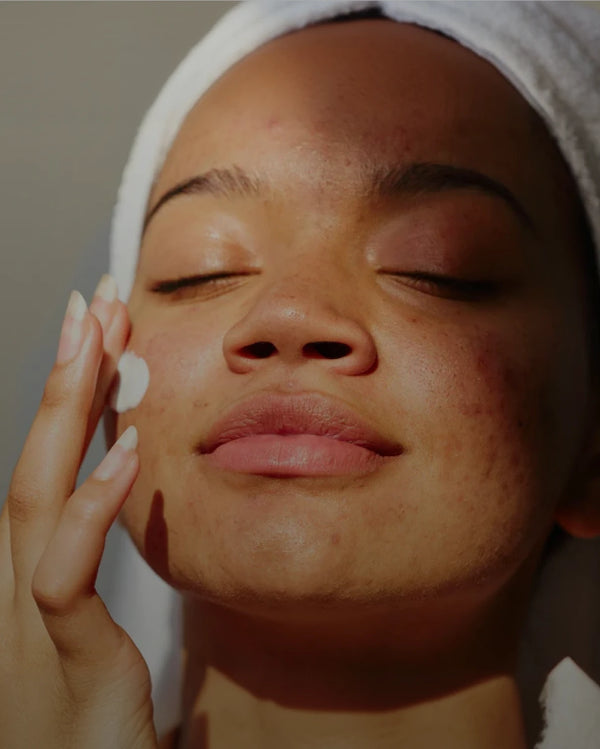 Pigmentation & Dark Spots